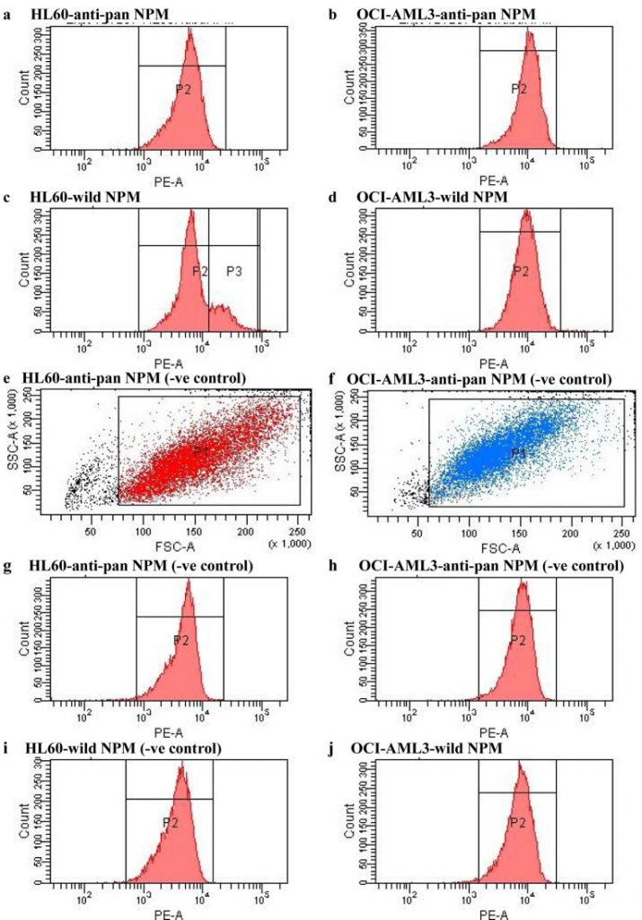 Quantitative Assay of Mutated Nucleophosmin in Acute Myeloid Leukemia. 